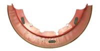 9M-1860 | 9M-1860 Service Brake Brake Disc Shield M939A2  (8).JPG